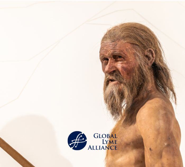 Ötzi The Ice Man His Story And Significance